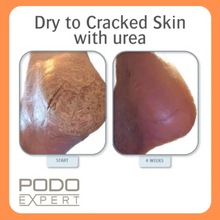 Load image into Gallery viewer, Podoexpert Dry To Cracked Skin Foam

